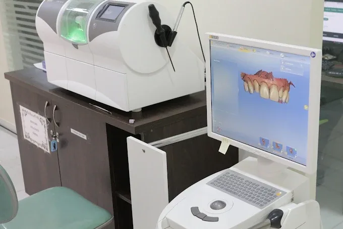 Scanner 3D e planejamento digital do sorriso na Inova Implantes